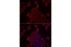 Immunofluorescence analysis of U2OS cells using PDHX antibody (ABIN5973826).
