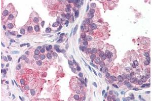 Immunohistochemistry (Formalin-fixed Paraffin-embedded Sections) (IHC (fp)) image for anti-SWI/SNF Related, Matrix Associated, Actin Dependent Regulator of Chromatin, Subfamily D, Member 2 (SMARCD2) (AA 431-480) antibody (ABIN6746995)