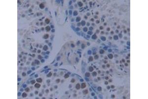 Used in DAB staining on fromalin fixed paraffin- embedded testis tissue (CSRP1 antibody  (AA 1-193))