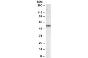 Western blot testing of human lung lysate with Cytokeratin 13 antibody at 0. (Cytokeratin 13 antibody)