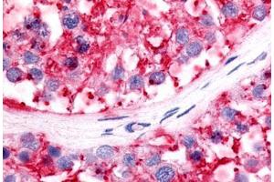 Anti-LRH-1 / NR5A2 antibody IHC staining of human testis. (NR5A2 + LRH1 antibody  (C-Term))