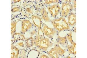 Immunohistochemistry of paraffin-embedded human kidney tissue using ABIN7165919 at dilution of 1:100 (PPP1R16B antibody  (AA 101-400))