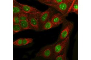 IF analysis of RbAp48 using anti-RbAp48 antibody (ABIN3043920) and anti-Beta Tubulin antibody (ABIN7602743). (Retinoblastoma Binding Protein 4 antibody  (C-Term))