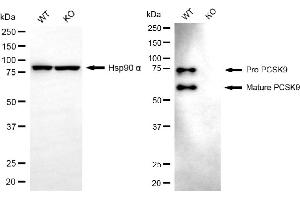 Western blotting analysis using PCSK9 antibody (ABIN7799927).