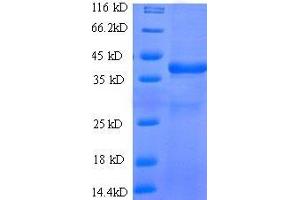 SDS-PAGE (SDS) image for WAP Four-Disulfide Core Domain 2 (WFDC2) (AA 31-124), (full length) protein (GST tag) (ABIN1047932)