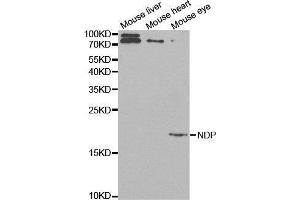 Western blot analysis of extracts of various cell lines, using NDP antibody. (Norrie Disease (Pseudoglioma) antibody  (AA 25-133))