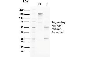 SDS-PAGE Analysis Purified PAPP-A Mouse Monoclonal Antibody (PAPPA/2715).