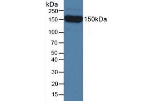 Detection of SEMA5B in Mouse Serum using Polyclonal Antibody to Semaphorin 5B (SEMA5B) (SEMA5B antibody  (AA 836-1013))