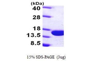 SDS-PAGE (SDS) image for Parvalbumin (PVALB) (AA 1-110) protein (His tag) (ABIN667261) (PVALB Protein (AA 1-110) (His tag))