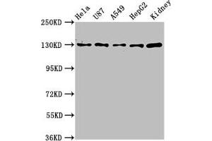 Western Blot Positive WB detected in: Hela whole cell lysate, U87 whole cell lysate, A549 whole cell lysate, HepG2 whole cell lysate, Mouse kidney tissue All lanes: SLC12A2 antibody at 6. (SLC12A2 antibody  (AA 110-282))