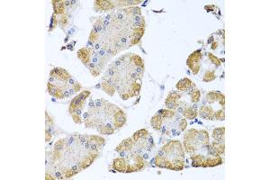 Immunohistochemistry of paraffin-embedded human stomach using ITPKB antibody (ABIN5972108) at dilution of 1/100 (40x lens). (ITPKB antibody)