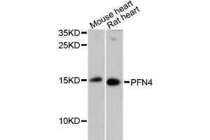 Western blot analysis of extracts of various cell lines, using PFN4 antibody (ABIN6291600) at 1:3000 dilution.