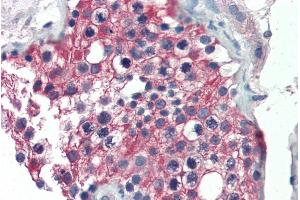 ABIN185587 (5µg/ml) staining of paraffin embedded Human Testis. (ALDH1A1 antibody  (Internal Region))