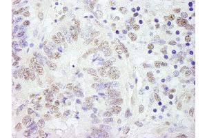 anti-Cleavage Stimulation Factor, 3' Pre-RNA, Subunit 3, 77kDa (CSTF3) (AA 667-717) antibody