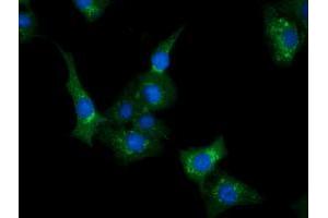Anti-CLPP mouse monoclonal antibody (ABIN2452910) immunofluorescent staining of COS7 cells transiently transfected by pCMV6-ENTRY CLPP (RC200301). (CLPP antibody)