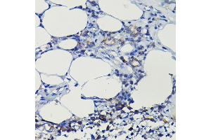 Immunohistochemistry of paraffin-embedded rat lung using iNOS Rabbit pAb  at dilution of 1:100 (40x lens). (NOS2 antibody  (AA 500-730))