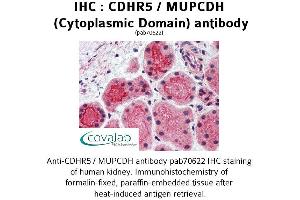 Image no. 2 for anti-Mucin and Cadherin-Like (CDHR5) (Cytoplasmic Domain) antibody (ABIN1732922) (CDHR5 antibody  (Cytoplasmic Domain))