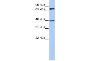 MPP5 antibody used at 1 ug/ml to detect target protein. (MPP5 antibody)