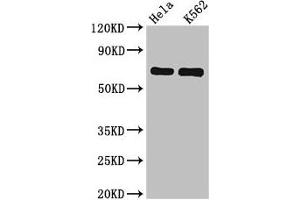 Western Blot Positive WB detected in: Hela whole cell lysate, K562 whole cell lysate All lanes: SNX9 antibody at 6. (SNX9 antibody  (AA 85-200))