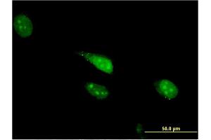 Immunofluorescence of monoclonal antibody to CDC23 on HeLa cell. (CDC23 antibody  (AA 491-591))