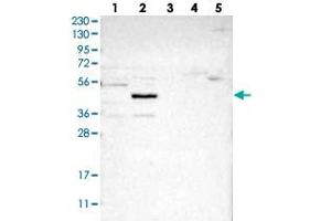 Western blot analysis of Lane 1: RT-4, Lane 2: U-251 MG, Lane 3: Human Plasma, Lane 4: Liver, Lane 5: Tonsil with NSUN5 polyclonal antibody  at 1:250-1:500 dilution.
