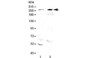 Western blot testing of 1) rat brain and 2) mouse brain lysate with RanBP2 antibody at 0.
