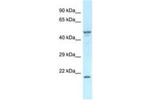 Image no. 1 for anti-Zinc Finger Protein 113 (ZFP113) (AA 200-249) antibody (ABIN6747579) (Zfp113 antibody  (AA 200-249))