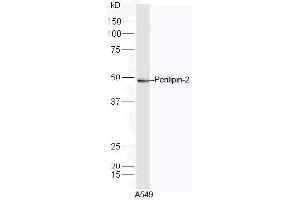 A549 lysate probed with Rabbit Anti-Perilipin 2 Polyclonal Antibody, Unconjugated  at 1:5000 for 90min at 37˚C. (ADRP antibody  (AA 341-437))