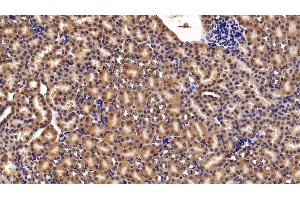 Detection of MGEA5 in Mouse Kidney Tissue using Polyclonal Antibody to Meningioma Expressed Antigen 5 (MGEA5) (MGEA5 antibody  (AA 319-450))