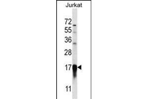 PFDN5 Antibody (Center) (ABIN657046 and ABIN2846213) western blot analysis in Jurkat cell line lysates (35 μg/lane). (PFDN5 antibody  (AA 79-108))