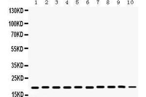 Western Blotting (WB) image for anti-Cofilin 1 (CFL1) (AA 122-152), (C-Term) antibody (ABIN3042746) (Cofilin antibody  (C-Term))