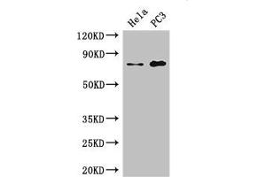 Western Blot Positive WB detected in: Hela whole cell lysate, PC-3 whole cell lysate All lanes: STRBP antibody at 2. (STRBP antibody  (AA 201-500))