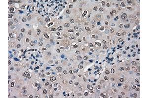 Immunohistochemical staining of paraffin-embedded Ovary tissue using anti-SLC18A2 mouse monoclonal antibody. (SLC18A2 antibody)