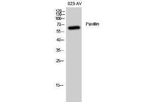 Western Blotting (WB) image for anti-Paxillin (PXN) (Thr508) antibody (ABIN3186344)