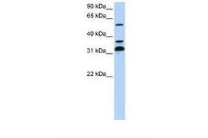 Image no. 1 for anti-Tripartite Motif Containing 9 (TRIM9) (C-Term) antibody (ABIN6737757) (TRIM9 antibody  (C-Term))