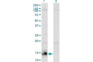 Western Blot analysis of CHURC1 expression in transfected 293T cell line by CHURC1 monoclonal antibody (M01), clone 2F9. (CHURC1 antibody  (AA 1-112))