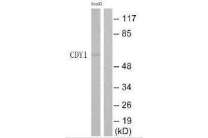 Western blot analysis of extracts from HepG2 cells, using CDY1 antibody.