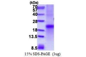 Image no. 1 for Tumor Necrosis Factor Receptor Superfamily, Member 1A (TNFRSF1A) protein (His tag) (ABIN1098686) (TNFRSF1A Protein (His tag))