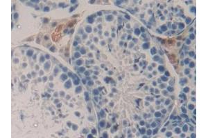 Detection of TNFSF9 in Mouse Testis Tissue using Polyclonal Antibody to Tumor Necrosis Factor Ligand Superfamily, Member 9 (TNFSF9) (TNFSF9 antibody  (AA 105-309))