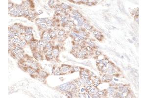 Immunohistochemistry (IHC) image for anti-Rap Guanine Nucleotide Exchange Factor (GEF) 2 (RAPGEF2) (AA 975-1025) antibody (ABIN7448889)
