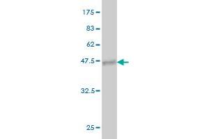 Western Blot detection against Immunogen (37. (PIP5K1C antibody  (AA 561-667))