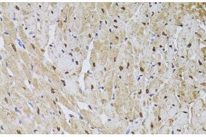 Immunohistochemistry of paraffin-embedded Rat heart using HUS1 Polyclonal Antibody at dilution of 1:100 (40x lens). (HUS1 antibody)