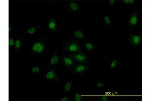 Immunofluorescence of monoclonal antibody to PLK1 on HeLa cell. (PLK1 antibody  (AA 1-603))