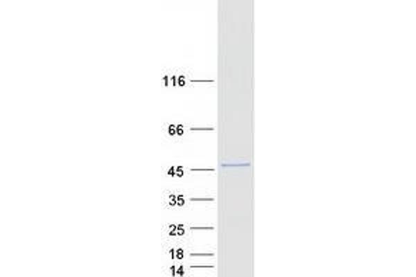 UBXN2B Protein (Myc-DYKDDDDK Tag)