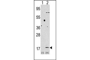 Western blot analysis of anti-LC3 (G8b) Pab 1802b in 293 cell line lysates transiently transfected with the LC3 (G8b) gene (2 μg/lane). (MAP1LC3A antibody  (C-Term))