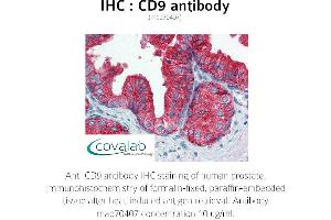 Image no. 1 for anti-CD9 (CD9) antibody (ABIN1723299) (CD9 antibody)