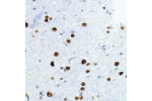 Immunohistochemistry of paraffin-embedded mouse spinal cord using FOSL1 Rabbit pAb (ABIN6131653, ABIN6140738, ABIN6140739 and ABIN6221016) at dilution of 1:100 (40x lens). (FOSL1 antibody  (AA 1-100))