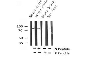 Western blot analysis of Phospho-B-RAF (Thr599) expression in various lysates (BRAF antibody  (pThr599))