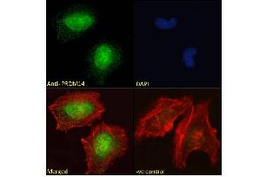 ABIN625828 Immunofluorescence analysis of paraformaldehyde fixed HeLa cells, permeabilized with 0.