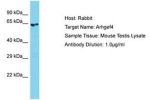 Image no. 1 for anti-rho Guanine Nucleotide Exchange Factor (GEF) 4 (ARHGEF4) (AA 51-100) antibody (ABIN6750412) (ARHGEF4 antibody  (AA 51-100))